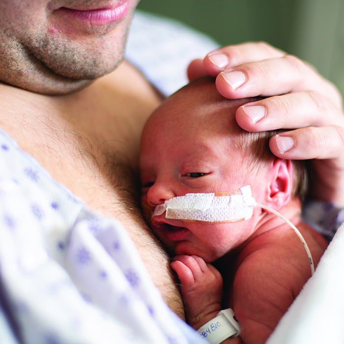Parent holding sleeping newborn with feeding tube